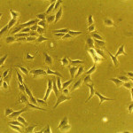 Effetto biostimolante del laser su cellule ossee