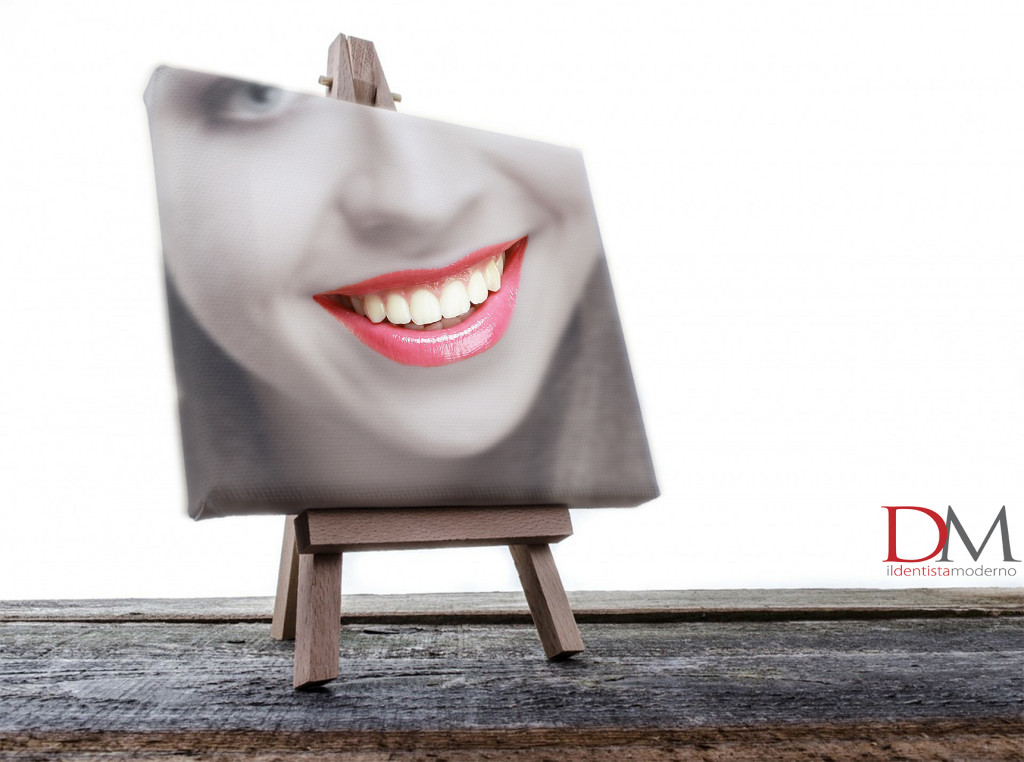 sorriso paziente faccette dentali_odontoiatria estetica