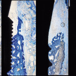 Impianti immediati post-estrattivi: fattori critici per la guarigione dei tessuti