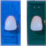 Il trattamento della dentina in restaurativa indiretta Il trattamento della dentina in restaurativa indiretta scelta colore odontoiatria restaurativa