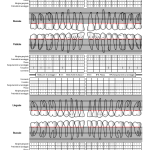 L’importanza di compilare la cartella parodontale gengive salute parodontale laserterapia cartella parodontale gengivite parodontite perimplantite