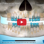 Dall’eruzione dentale ad anomalie e disodontiasi eruzione dentale disodontiasi