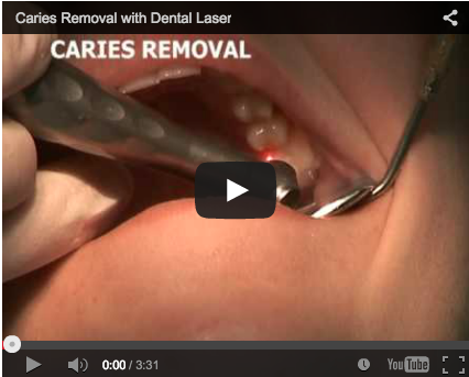 laser erbium laserterapia odontoiatria