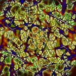 Neuropatia iatrogena in odontoiatria: cause diagnosi e terapia odontoiatria diagnosi neuropatia