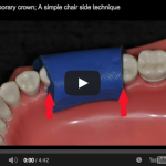 Temporary crown, a simple direct technique Temporary crown, a simple direct technique