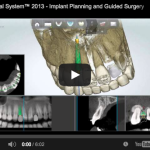 Opportunities in guided implantology implantologia guidata chirurgia guidata