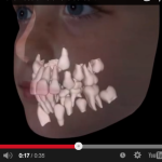 Transizione attraverso la dentizione mista e approdo alla dentizione permanete dentizione mista dentizione permanente eruzione