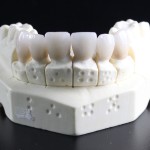 Resistenza di corone in composito fresato CAD/CAM in funzione dello spessore ossido di zirconio protesi corona disilicato di litio