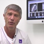 I vantaggi dell’impronta ottica