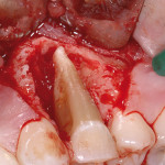 Semplicità e innovazione in conservativa