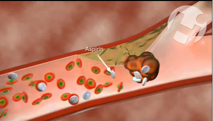 DM_il dentista moderno_aspirina_paziente odontoiatrico in terapia antiaggragante