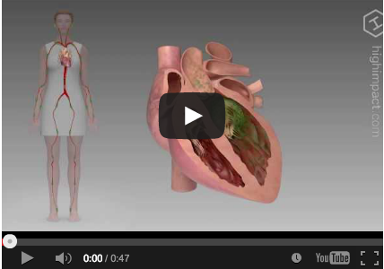 DM_il dentista moderno_profilassi endocardite Batterica_odontoiatria