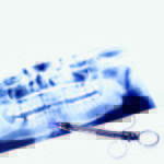 Radiologia e radioprotezione nello studio medico odontoiatrico Dentista-moderno-radiologia-odontoiatri.jpg