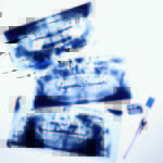 Radioprotezione: ruoli del responsabile di impianto radiologico Dentista-moderno-radiologia-odontoiatri-radiologico-radioprotezione