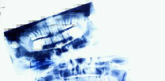 Radioprotezione: ruoli del responsabile di impianto radiologico Dentista-moderno-radiologia-odontoiatri-radiologico-radioprotezione