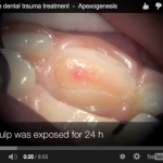 Eziologia dei traumi dentali: fattori di rischio comportamentali