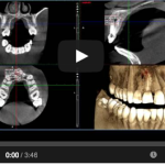 Traumi dentali: eventi imprevedibili, incidenti e violenze eziologia traumi fattori di rischio