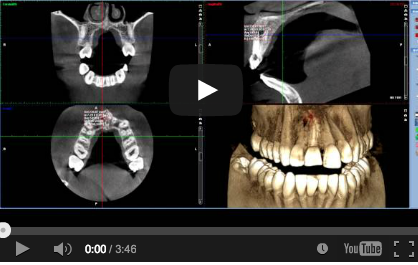 eziologia traumi fattori di rischio