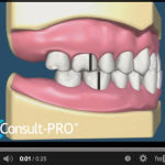 I primi passi per la diagnosi in ortodonzia DM_il dentista moderno_ I primi passi per la diagnosi in ortodonzia