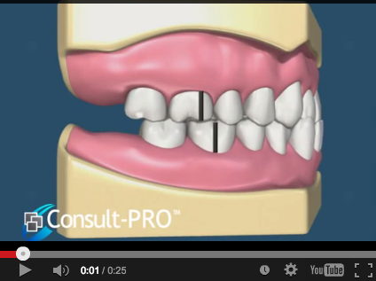 DM_il dentista moderno_ I primi passi per la diagnosi in ortodonzia