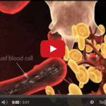 Fare diagnosi di parodontite può cambiare una vita DM_il dentista moderno_ diagnosi di parodontite_correlazioni sistemiche