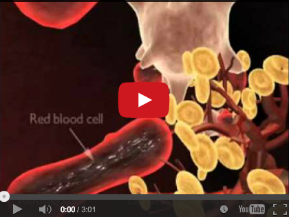 DM_il dentista moderno_ diagnosi di parodontite_correlazioni sistemiche