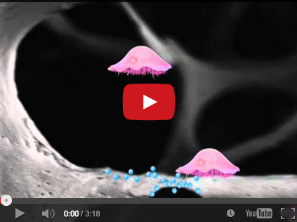 DM_il dentista moderno_bifosfonati le linee guida e raccomandazioni_