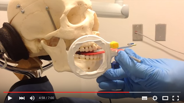 DM_il dentista moderno_bite wing_