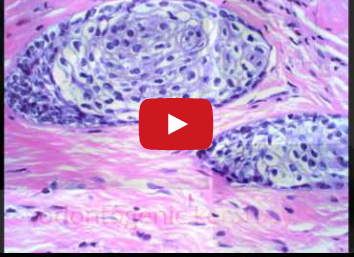 DM_il dentista moderno_cisti dei mascellari