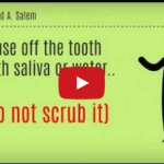Quanto costano le lesioni dentali da trauma in tempo e denaro? DM_il dentista moderno_lesioni dentali da trauma_costo tempo denaro