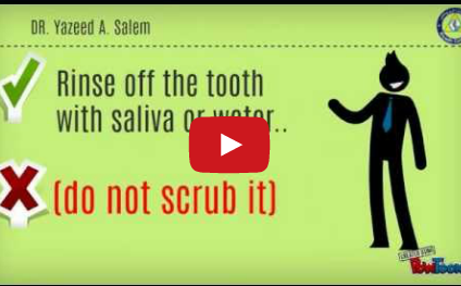 DM_il dentista moderno_lesioni dentali da trauma_costo tempo denaro