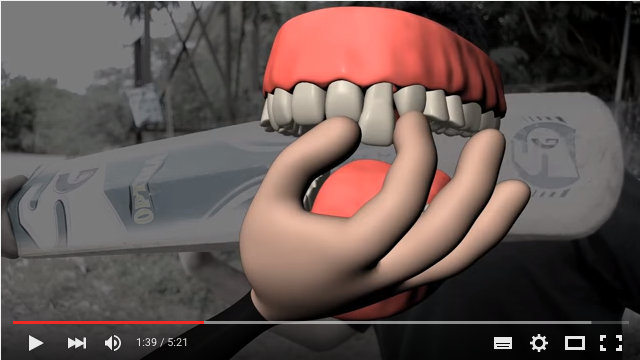 DM_il dentista moderno_prevenzione lesioni dentali da trauma 1