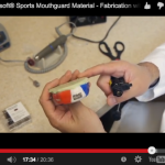 Traumi dentali da sport: prevenirli indossando adeguate protezioni DM_il dentista moderno_traumi dentali_realizzazione paradenti