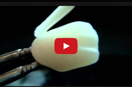 DM_il dentista moderno_CAD-CAM chairside_odontoiatria