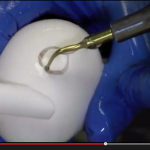 Ultrasuoni: l’utilizzo della tecnologia piezoelettrica in odontoiatria DM_il dentista moderno_Ultrasuoni utilizzo della tecnologia piezoelettrica in odontoiatria