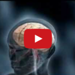 Nevralgia del trigemino: sintomi e diagnosi DM_il dentista moderno_patologia orale_stomatopirosi primaria e secondaria_nevralgia del trigemino_diagnosi_sintomi