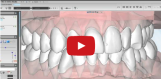 DM_il dentista moderno_malocclusioni_diagnosi in ortodonzia