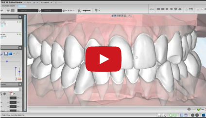 DM_il dentista moderno_malocclusioni_diagnosi in ortodonzia