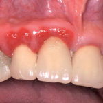 Malpractice odontoiatrica: errori diagnostico-terapeutici, di comportamento e di gestione nei contenziosi