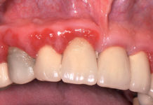 Malpractice odontoiatrica: errori diagnostico-terapeutici, di comportamento e di gestione nei contenziosi