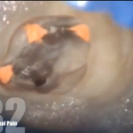 Endodonzia: fallimenti e ritrattamenti Dm_il dentista moderno_Endodonzia fallimenti e ritrattamenti