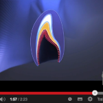 La genetica e le caratteristiche dell’amelogenesi imperfetta DM_il dentista moderno_amelogenesi imperfetta