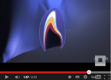 DM_il dentista moderno_amelogenesi imperfetta