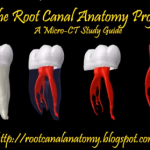 Endodonzia: analisi delle conformazioni canalari dente per dente DM_il dentista moderno_endodonzia_variazioni anatomiche_anantomia canalare