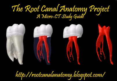 DM_il dentista moderno_endodonzia_variazioni anatomiche_anantomia canalare