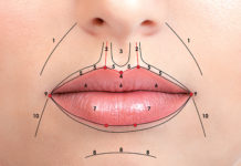 Tutto nasce da un sorriso