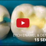 Basi biochimiche dell’adesione in odontoiatria restaurativa DM_il dentista moderno_ adesivo smalto dentinale_ total etch self etch_adesione in odontoiatria restaurativa