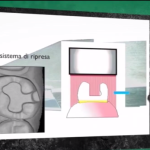 Fili di retrazione gengivale: servono per una buona impronta digitale? DM_il dentista moderno_fili di retrazione gengivale_impronta digitale