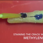 Frattura verticale di elemento dentario: “autopsia di un dente” DM_il dentista moderno_frattura verticale di elemento dentario