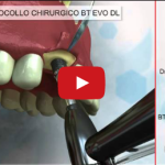 Impianti ad esagono esterno o interno? DM_il dentista moderno_impianti ad esagono esterno e interno